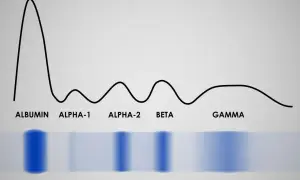 Wykres proteinogramu z frakcjami: albumina, alfa-1, alfa-2, beta, gamma. Widoczne pasma białek.