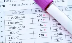 Wyniki badań krwi: glukoza, cholesterol, trójglicerydy, HDL-C, LDL-C. Szybko uzyskane dane do analizy.