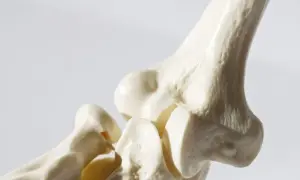 Jaki lek na osteoporozę? Poznaj skuteczne opcje leczenia i ich działanie