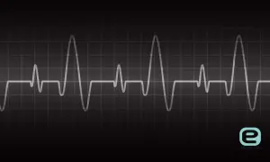 Nieregularny zapis EKG na czarnym tle. Pokazuje, jakie są objawy arytmii serca, gdy rytm jest zaburzony.