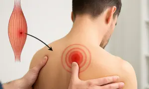 Un point douloureux sur l'épaule d'un homme, illustrant un trigger point musculaire.