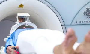 Pacjent leży w aparacie do rezonansu magnetycznego. Przed badaniem warto dowiedzieć się, czy do tomografii trzeba zdjąć kolczyki.