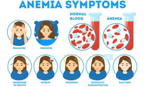 Sintomi di anemia: mal di testa, insonnia, affanno, stanchezza, vertigini, difficoltà di concentrazione, pelle pallida. Il ferro basso quando preoccuparsi è indicato da questi segnali.