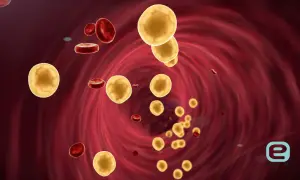 Żółte kuleczki cholesterolu i czerwone krwinki w naczyniu krwionośnym. Wysoki cholesterol może prowadzić do problemów zdrowotnych.