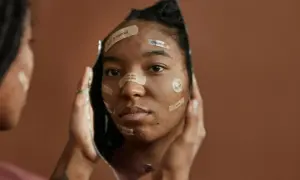 Riflesso di un volto con cerotti che recitano "acne is normal", "imperfect", "i'm not my skin", quando ti fanno sentire una nullità.
