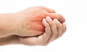 Schmerzende Hand mit Knochenstruktur und roter Entzündung. Ein Hoffnungsschimmer für eine Wunderwaffe gegen Arthrose Finger.
