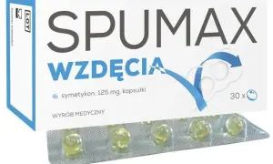 Jakie leki na gazy? 10 skutecznych sposobów na wzdęcia