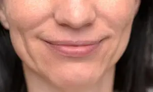 Zbliżenie na usta kobiety, których opadające kąciki ust nadają jej lekko smutny wyraz.