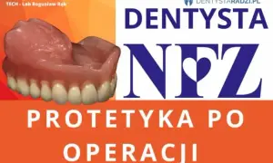 Gdzie zrobić protezę zębową na NFZ i uniknąć długiego czekania