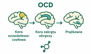 Schemat mózgu ilustrujący zmiany w obszarach kory przy OCD. Choroba wpływa na korę oczodołowo-czołową, korę zakrętu obręczy i prążkowie.