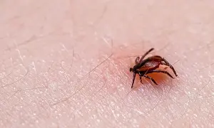 Zbliżenie na ludzką skórę z widocznym, brązowym kleszczem. Pajęczak ma osiem nóg i wyraźnie zaznaczone ciało. Wokół niego widać drobne włoski.