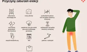 Ilustracja przedstawia przyczyny zaburzeń erekcji: od problemów neurologicznych, przez urazy, choroby prostaty, po zespół metaboliczny, leki, nadwagę, palenie i narkotyki.