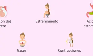 Ilustraciones de causas comunes de dolor abdominal en el embarazo: presión uterina, estreñimiento, acidez, gases y contracciones.