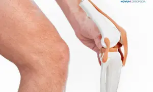 Model anatomiczny stawu kolanowego trzymany przez dłoń obok ludzkiego kolana.