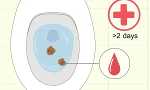 Biegunka w ciąży? W toalecie widać niepokojące objawy. Czerwony krzyż i kropla krwi sugerują, że czas szukać pomocy medycznej, zwłaszcza gdy trwa to dłużej niż 2 dni.