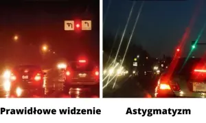 Astygmatyzm: czy można go wyleczyć? Poznaj metody korekcji