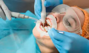 Dentysta wykonuje zabieg higienizacji zębów, usuwając kamień ultradźwiękami. Pacjent ma założony retraktor i okulary ochronne.