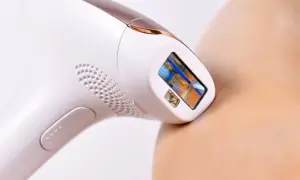 Jak często wykonywać depilację laserową w domu, aby uniknąć błędów?