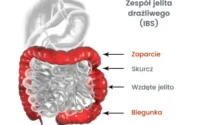 Syndrom Habba: Objawy, które mylisz z IBS. Jak rozpoznać i leczyć?