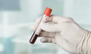 Gazometria: Co to za badanie? Zrozum wyniki i nie bój się pobrania