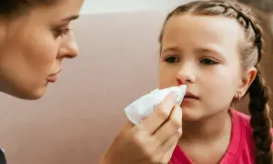 Mama pomaga córce z krwią z nosa. Przyczyny krwawienia z nosa mogą być różne, np. uraz, suche powietrze.