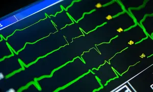 Zielone linie na czarnym ekranie pokazują zapis ekg serca, analizę pracy serca.