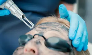 Peeling węglowy co daje: niezwykłe korzyści dla Twojej skóry