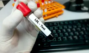 Jak bezpiecznie podnieść cholesterol? Sprawdź skuteczne metody i porady
