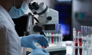 Czego nie wiesz o badaniu IgG? Zrozumienie jego znaczenia