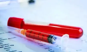 Co oznacza WBC w badaniu krwi: Kluczowe informacje o leukocytach