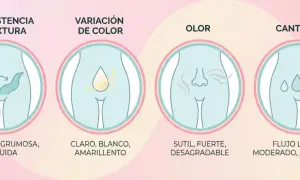 Ilustración de los tipos de flujo vaginal: consistencia, color, olor y cantidad. Se describen las variaciones normales y las que podrían indicar un problema.