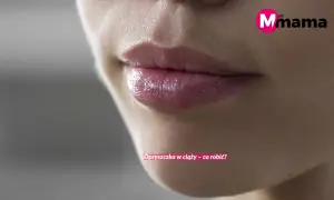 Zbliżenie na usta kobiety z widoczną opryszczką. Tekst informuje o przyczynach opryszczki na ustach i sposobach radzenia sobie z nią w ciąży.