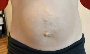 En mage med synliga delade magmuskler och navel.