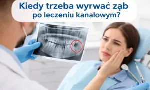Dentysta pokazuje pacjentce prześwietlenie zęba, wskazując na problem. Kiedy trzeba rozważyć usuwanie zębów leczonych kanałowo?