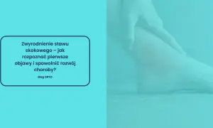 Zbliżenie na stopę i tekst o zwyrodnieniu stawu skokowego.