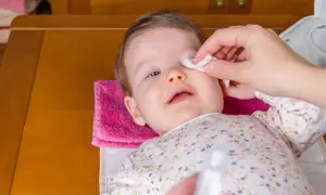 Delikatne przemywanie oka niemowlaka wacikiem nasączonym solą fizjologiczną.