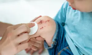 Dłoń delikatnie przemywa otarcie na kolanie dziecka. Dla osób z hemofilią takie urazy wymagają szczególnej uwagi.