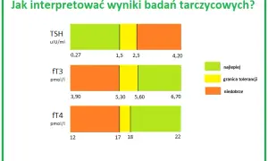 Badanie TSH: Co to za badanie? Normy i interpretacja wyników