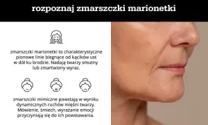 Skuteczne metody na zmarszczki po 50, które naprawdę działają