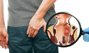 Nie wstydź się! Proktolog: Kiedy iść i jak wygląda wizyta?
