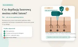 Czy depilacja laserowa jest bezpieczna latem? Tak, ale unikaj opalonej skóry i chroń ją przed słońcem.
