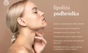 Kobieta z idealnie zarysowaną linią żuchwy po zabiegu lipolizy podbródka. Efekty: redukcja drugiego podbródka, wysmuklenie dolnej części twarzy.