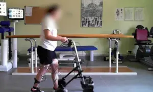 Persona con invalidità cammina con deambulatore, sensori alle gambe per neurostimolatore midollare.