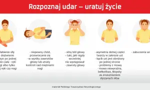 Objawy udaru mózgu: osłabienie kończyn, zaburzenia mowy, bóle głowy, problemy z widzeniem. Pierwsza pomoc jest kluczowa.