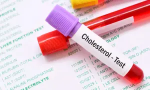 Probówka z napisem "Cholesterol - Test" leży na papierze z listą badań, m.in. lipidogram co to jest.