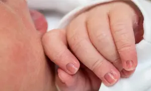 Delikatna dłoń niemowlaka, z widocznym paznokciem, który zaczyna się lekko zaginać.