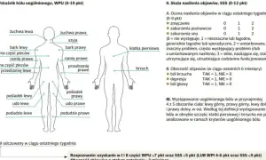 Schemat przedstawia lokalizację bólu w fibromialgii. Co to jest fibromialgia? To zespół objawów, m.in. bólu, zmęczenia, zaburzeń snu.