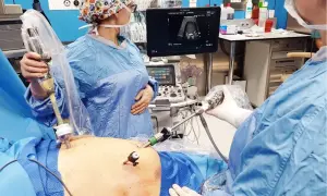 Co robi chirurg? Od diagnozy po salę operacyjną pełny przewodnik.