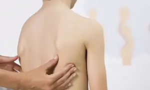 Mani di un medico esaminano la schiena di un bambino, evidenziando una possibile scoliosi cervicale.