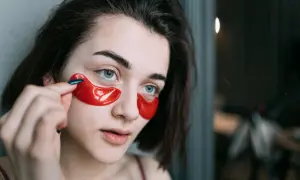 Cera naczynkowa: objawy. Rozpoznaj rumień i odróżnij od trądziku!